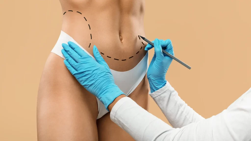 Kayseri Liposuction